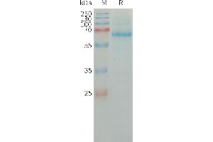 Human PLAT Protein, His Tag on SDS-PAGE under reducing condition. (PLAT Protein (AA 36-562) (His tag))