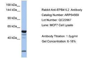 EPB41L2 antibody used at 1 ug/ml to detect target protein. (EPB41L2 antibody  (Middle Region))