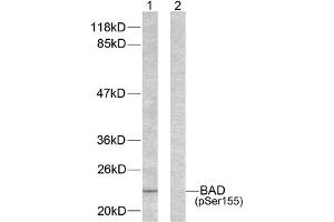 Western blot analysis of extracts from 293 cells using BAD (phospho-Ser155) antibody. (BAD antibody  (pSer155))