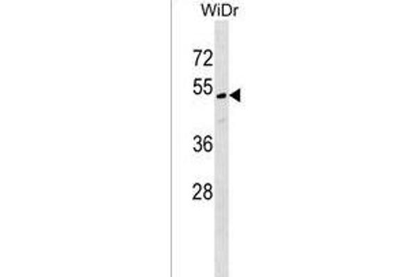 MLF1IP antibody  (C-Term)