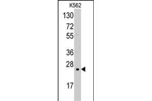 Western blot analysis of anti-SOD2 Pab  in K562 cell line lysates (35 μg/lane). (SOD2 antibody)