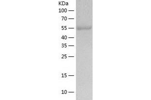 ALDH2 Protein (AA 20-519) (His tag)