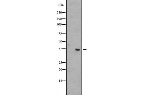 WNT8B antibody  (Internal Region)