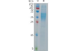 Human FB Protein, His Tag on SDS-PAGE under reducing condition. (FCGR3B Protein (AA 17-199) (His tag))