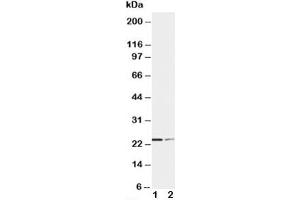 Western blot testing of SOCS1 antibody and Lane 1:  HT1080 (SOCS1 antibody  (C-Term))