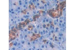 IHC-P analysis of Human Tissue, with DAB staining. (RIPK1 antibody  (AA 17-289))