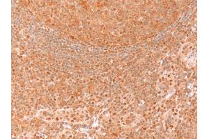 Immunohistochemistry (IHC) image for anti-Glyceraldehyde-3-Phosphate Dehydrogenase (GAPDH) (C-Term) antibody (ABIN185240)