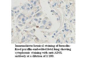 Image no. 1 for anti-Adenylosuccinate Lyase (ADSL) antibody (ABIN1574515) (Adenylosuccinate Lyase antibody)