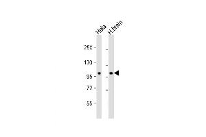 Western Blot at 1:1000 dilution Lane 1: Hela whole cell lysate Lane 2: human brain lysate Lysates/proteins at 20 ug per lane. (NCOA7 antibody  (N-Term))