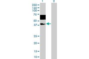 Lane 1: MAGEA10 transfected lysate ( 40. (MAGEA10 293T Cell Transient Overexpression Lysate(Denatured))