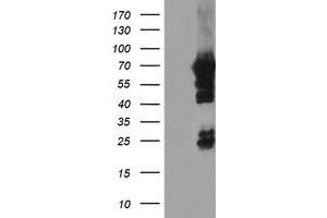 HEK293T cells were transfected with the pCMV6-ENTRY control (Left lane) or pCMV6-ENTRY NMT2 (Right lane) cDNA for 48 hrs and lysed. (NMT2 antibody)