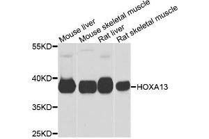 Western blot analysis of extracts of various cell lines, using HOXA13 antibody (ABIN6003554) at 1/1000 dilution. (HOXA13 antibody)