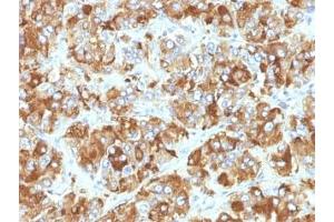 Immunohistochemistry (Formalin-fixed Paraffin-embedded Sections) (IHC (fp)) image for anti-Chromogranin A (CHGA) antibody (ABIN3024536)