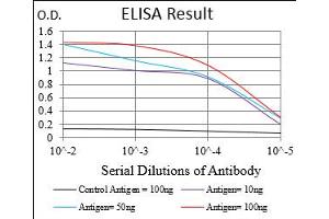 Fig. (PRKACA antibody  (AA 1-120))