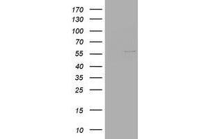 Image no. 1 for anti-Vimentin (VIM) (AA 210-466) antibody (ABIN1491202) (Vimentin antibody  (AA 210-466))