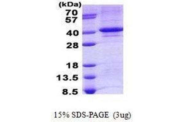 TDP1 Protein