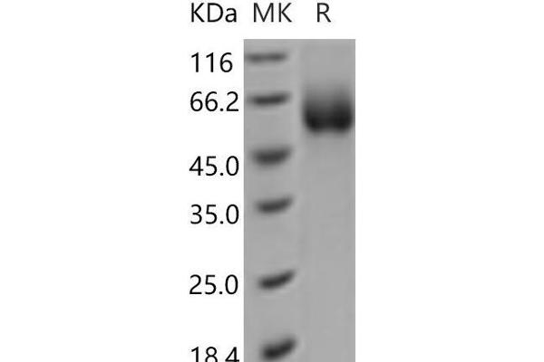 SLC3A2 Protein (His tag)