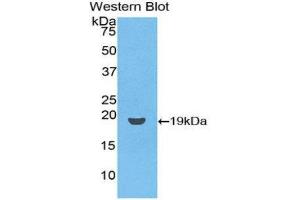 Western Blotting (WB) image for anti-CD59 (CD59) (AA 26-102) antibody (ABIN1174495) (CD59 antibody  (AA 26-102))