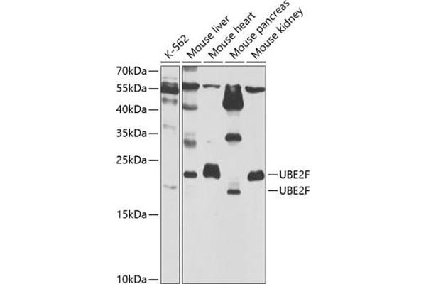 UBE2F antibody  (AA 1-185)