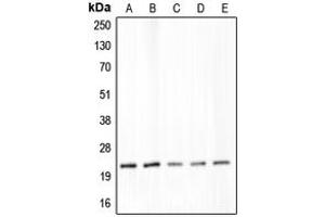 Western blot analysis of Claudin 4 expression in DLD (A), SW480 (B), LS1034 (C), MIA (D), PaCa2 (E) whole cell lysates. (Claudin 4 antibody  (C-Term))