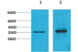 Western Blot (WB) analysis of 1) C2C12, 2) Rat Heart Tissue with Cyclin D1 Rabbit Polyclonal Antibody diluted at 1:2000. (Cyclin D1 antibody)