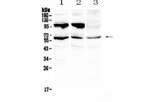 Western blot analysis of Perilipin A using anti-Perilipin A antibody . (PLIN1 antibody)