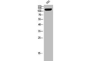 Western Blot analysis of VEC cells using Phospho-Tie-2 (Y992) Polyclonal Antibody (TEK antibody  (pTyr992))