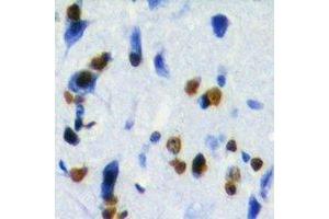 Immunohistochemical analysis of ZBTB48 staining in human brain formalin fixed paraffin embedded tissue section. (ZBTB48 antibody)