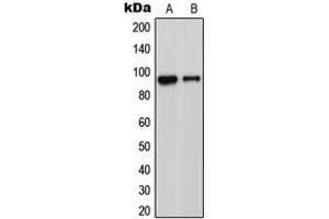 Western blot analysis of ADAM23 expression in Jurkat (A), MCF7 (B), Raw264. (Adam23 antibody  (C-Term))