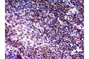 Formalin-fixed, paraffin-embedded human tonsil stained with NuMA antibody (A73-B/D12) (NUMA1 antibody)