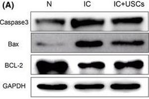 Western Blotting (WB) image for anti-B-Cell CLL/lymphoma 2 (BCL2) (N-Term) antibody (ABIN2857047)