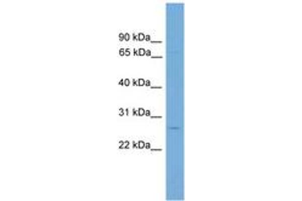 GLUT12 antibody  (AA 551-600)