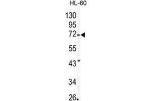 Western Blotting (WB) image for anti-Matrix Metallopeptidase 24 (Membrane-inserted) (MMP24) antibody (ABIN3002550) (MMP24 antibody)