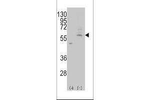 Western blot analysis of PMAT(Slc29a4) using rabbit polyclonal PMAT(Slc29a4) Antibody using 293 cell lysates (2 ug/lane) either nontransfected (Lane 1) or transiently transfected with the PMAT(Slc29a4) gene (Lane 2). (SLC29A4 antibody  (C-Term))