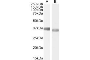 Western Blotting (WB) image for anti-Glyceraldehyde-3-Phosphate Dehydrogenase (GAPDH) (C-Term) antibody (ABIN185240)