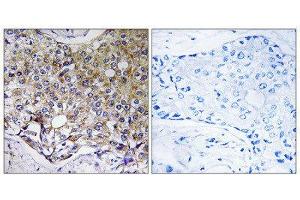 Immunohistochemistry (IHC) image for anti-Autophagy related 4A Cysteine Peptidase (ATG4A) (Internal Region) antibody (ABIN1851199) (ATG4A antibody  (Internal Region))