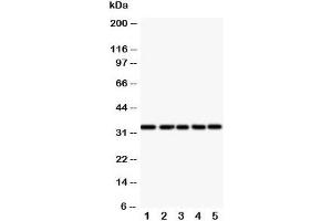 Western blot testing of E2F6 antibody and Lane 1:  HeLa;  2: COLO320;  3: A549;  4: MCF-7;  5: SMMC-7721 cell lysate (E2F6 antibody  (Middle Region))