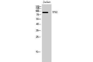 Western Blotting (WB) image for anti-TPX2, Microtubule-Associated, Homolog (Xenopus Laevis) (TPX2) (Internal Region) antibody (ABIN3177774) (TPX2 antibody  (Internal Region))