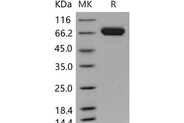 EPH Receptor A7 Protein (EPHA7) (His tag)