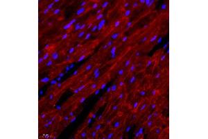 Immunofluorescence of paraffin embedded mouse heart using DMD (ABIN7073791) at dilution of 1:650 (400x lens) (Dystrophin antibody)