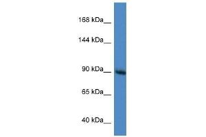 Western Blot showing Rasa1 antibody used at a concentration of 1. (RASA1 antibody  (C-Term))