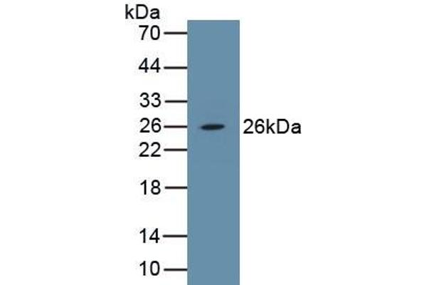 PDGFB antibody  (AA 84-199)