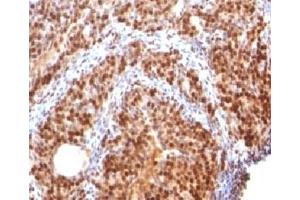 Immunohistochemistry (Formalin-fixed Paraffin-embedded Sections) (IHC (fp)) image for anti-Small Ubiquitin Related Modifier 2 (SUMO2) antibody (ABIN3026258)