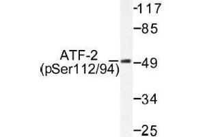 Image no. 1 for anti-Activating Transcription Factor 2 (ATF2) (pSer112), (pSer94) antibody (ABIN317963) (ATF2 antibody  (pSer94, pSer112))