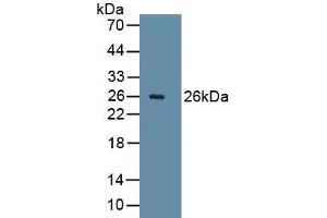 Detection of Recombinant Ki67P, Rat using Polyclonal Antibody to Ki-67 Protein (Ki-67) (Ki-67 antibody  (AA 2969-3119))