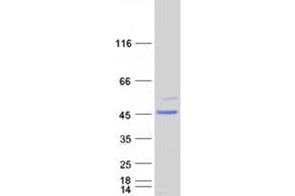 ARMC8 Protein (Transcript Variant 3) (Myc-DYKDDDDK Tag)