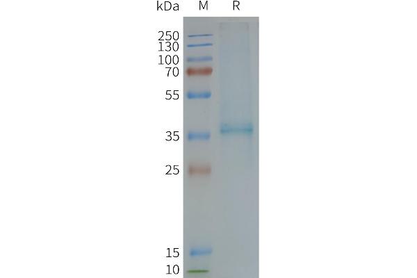 XCR1 Protein