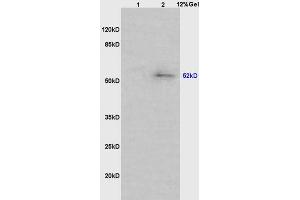 Lane 1: mouse intestine lysates Lane 2: mouse lung lysates probed with Anti phospho-MAPKAPK5(Ser93) Polyclonal Antibody, Unconjugated (ABIN710561) at 1:200 in 4 °C. (MAPKAP Kinase 5 antibody  (pSer93))