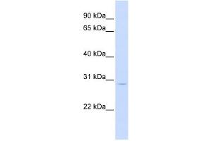 LIF antibody used at 1 ug/ml to detect target protein. (LIF antibody)