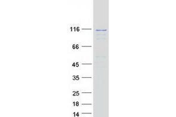 EFTUD2 Protein (Transcript Variant 1) (Myc-DYKDDDDK Tag)